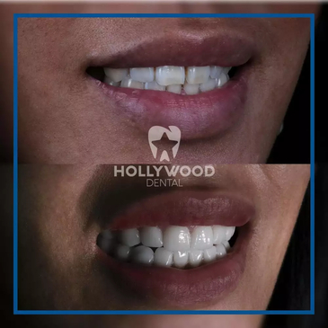 Slider image (5) Hollywood Dental Izmir Turkey